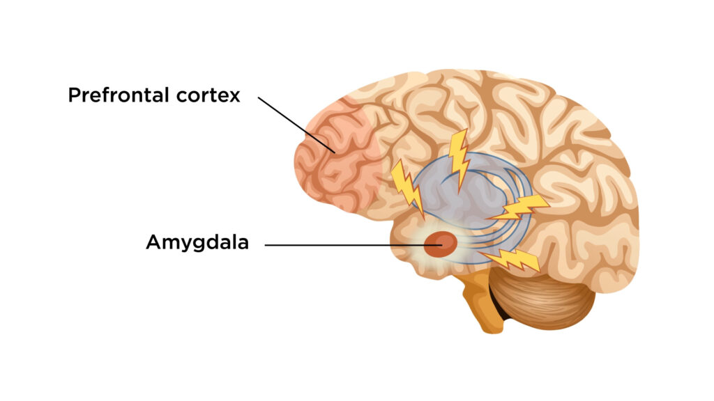Emotional brain - what everybody should know​ about suicide